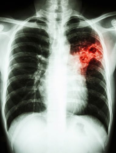Beratung, Zweitmeinung, Diagnostik und Indikationsstellung zu operativen Eingriffen