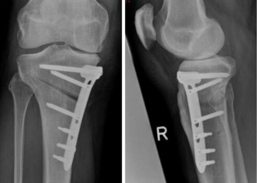 Diagnostisches Röntgen und Ultraschall