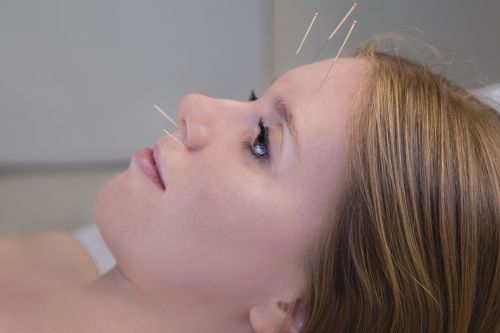 TCM (Traditionelle Chinesische Medizin) / Akupunktur