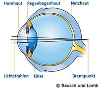 weitsichtiges Auge